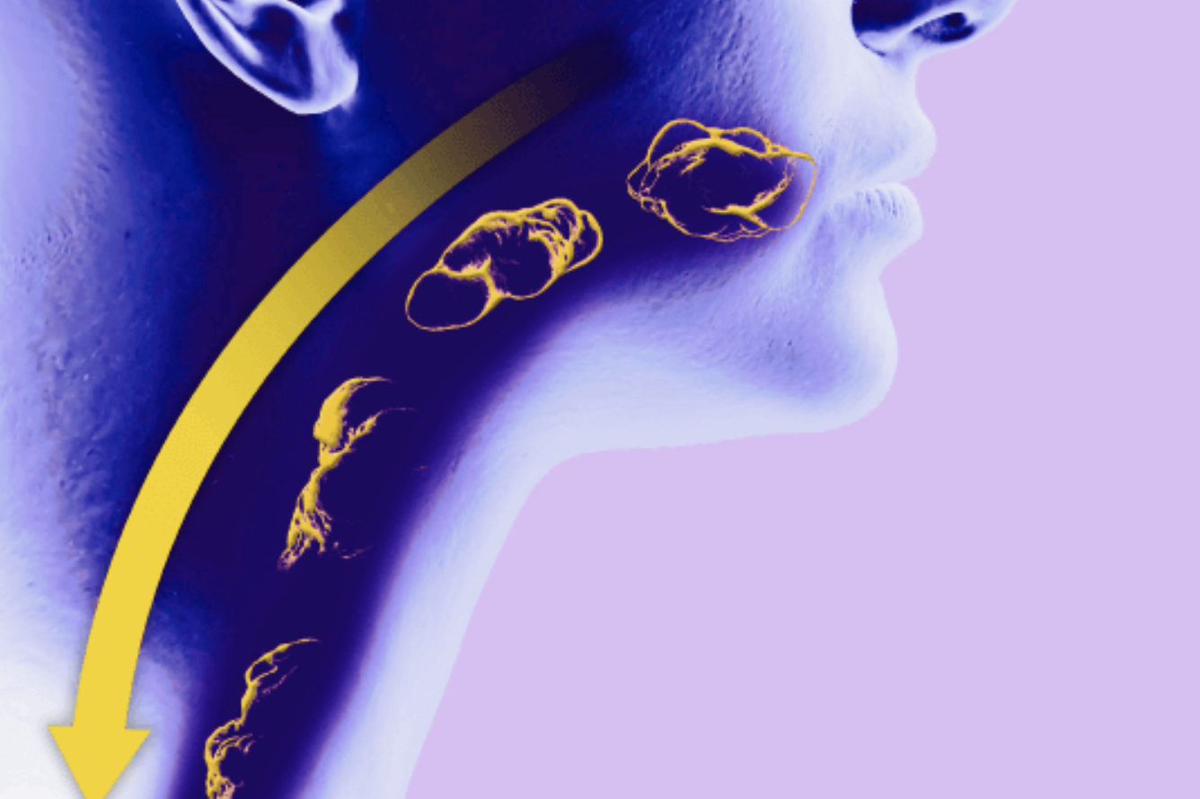 Understanding Dupilumab for Eosinophilic Esophagitis: A Breakthrough Treatment